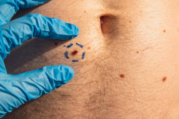 Biopsies – Alpha Hospital Group