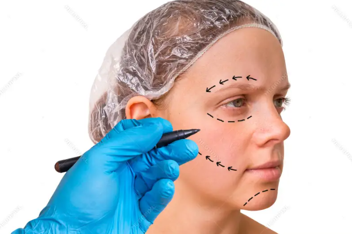Facelift 1 – Alpha Hospital Group
