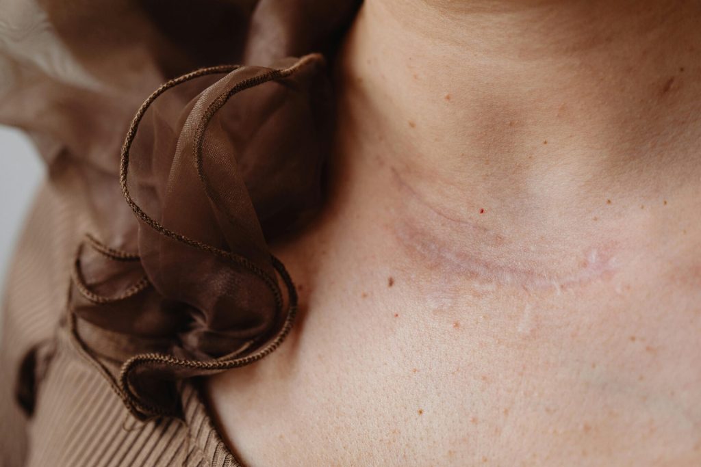 Scar revision – Alpha Hospital Group