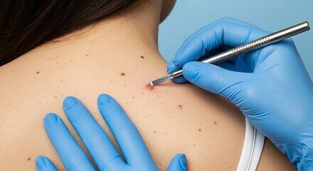 Skin Cancer – Alpha Hospital Group