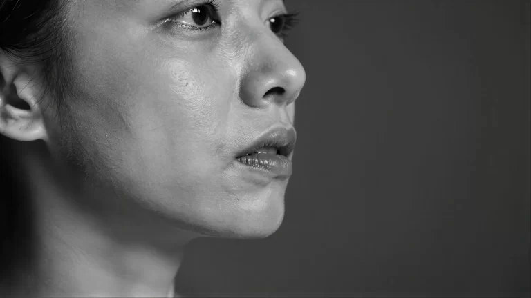 Facial Fat Transfer at Alpha Hospital Group